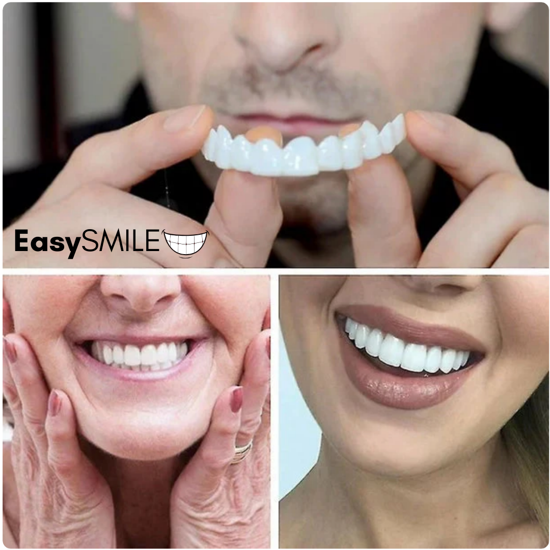 EasySmile | Carillas dentales de cerámica adaptables