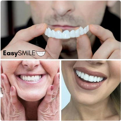 EasySmile | Carillas dentales de cerámica adaptables