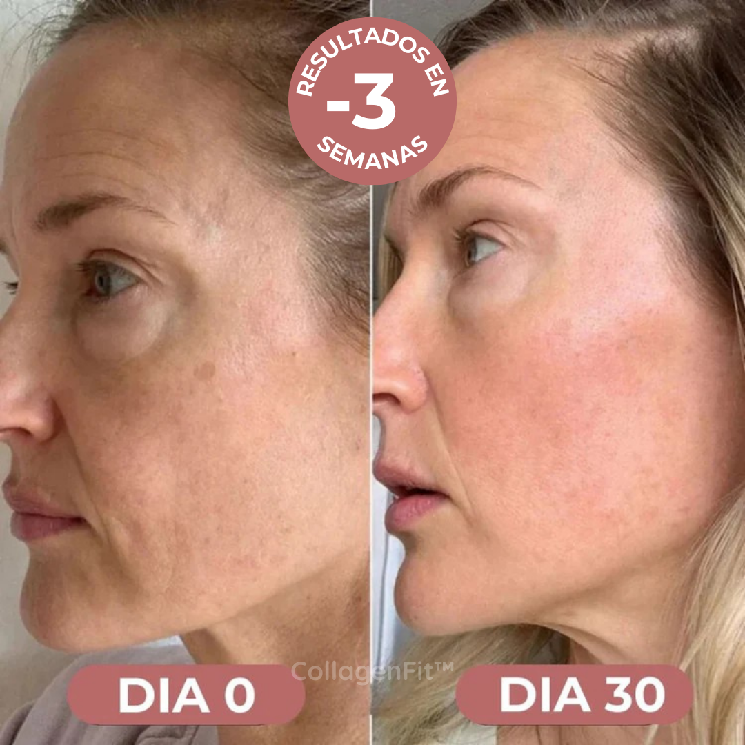 CollagenFit| Máscara de Colágeno Reafirmante e Hidratante