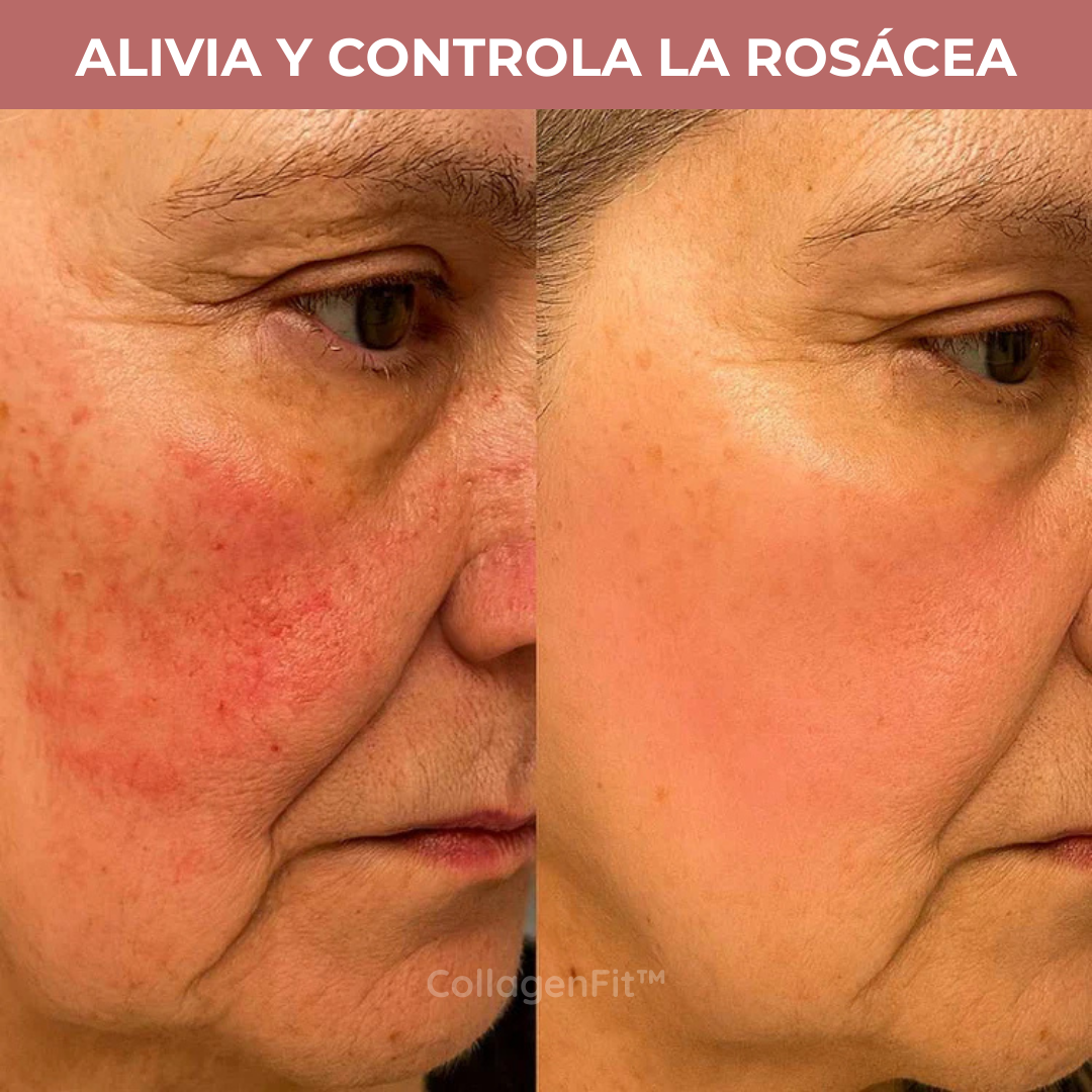 CollagenFit| Máscara de Colágeno Reafirmante e Hidratante